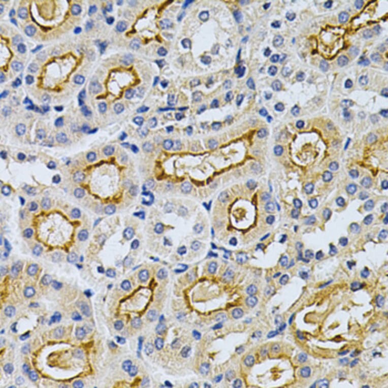 Immunohistochemistry - Anti-GRK2 Antibody (A13580) - Antibodies.com