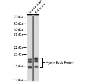 Western Blot - Anti-Myelin Basic Protein Antibody (A13581) - Antibodies.com