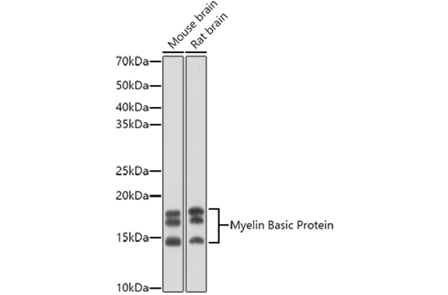 Western Blot - Anti-Myelin Basic Protein Antibody (A13581) - Antibodies.com