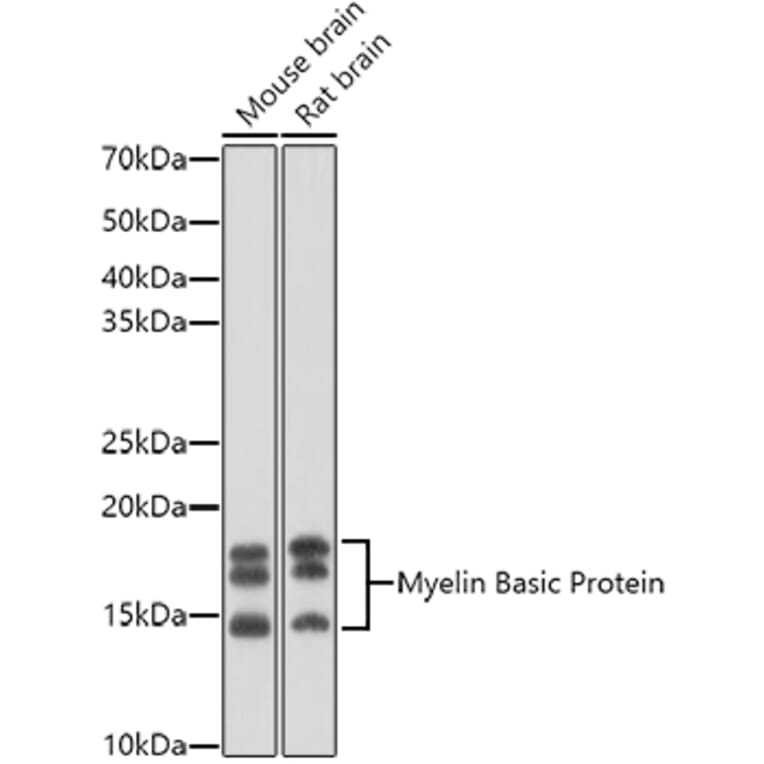 Western Blot - Anti-Myelin Basic Protein Antibody (A13581) - Antibodies.com