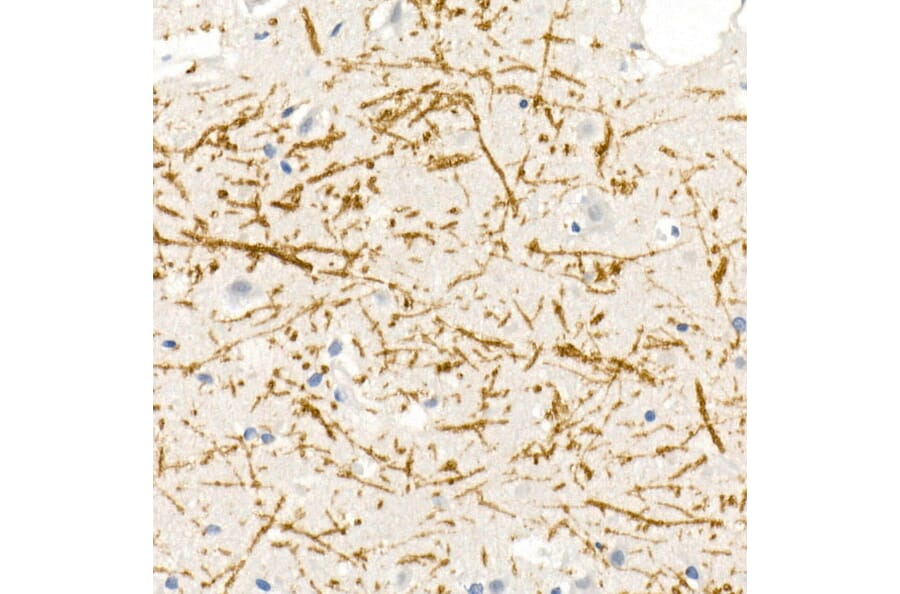 Immunohistochemistry - Anti-Myelin Basic Protein Antibody (A13581) - Antibodies.com