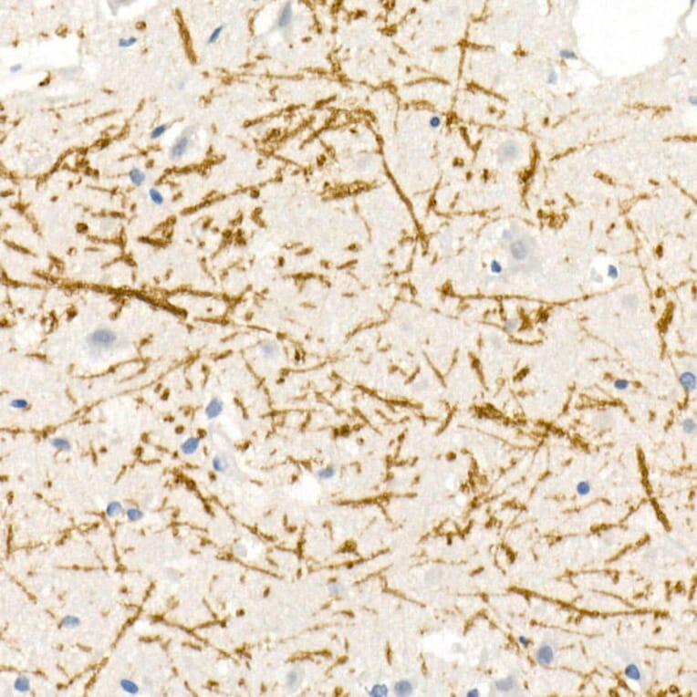 Immunohistochemistry - Anti-Myelin Basic Protein Antibody (A13581) - Antibodies.com