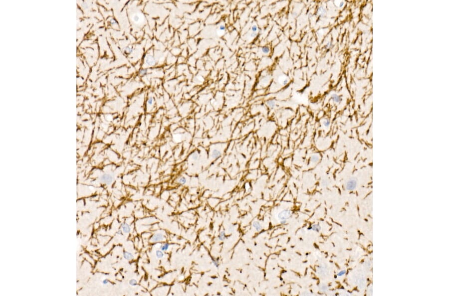 Immunohistochemistry - Anti-Myelin Basic Protein Antibody (A13581) - Antibodies.com