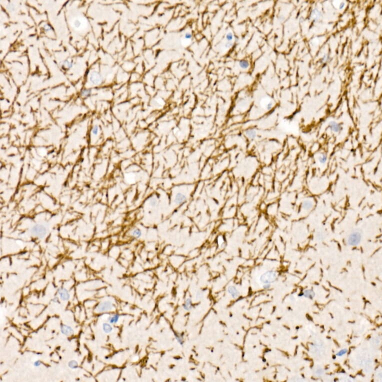 Immunohistochemistry - Anti-Myelin Basic Protein Antibody (A13581) - Antibodies.com