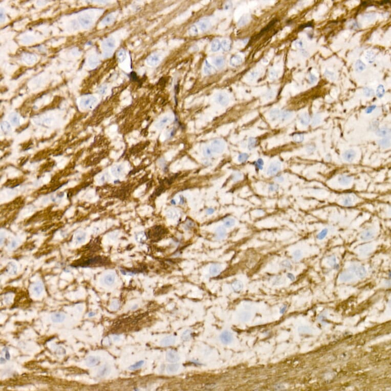 Immunohistochemistry - Anti-Myelin Basic Protein Antibody (A13581) - Antibodies.com