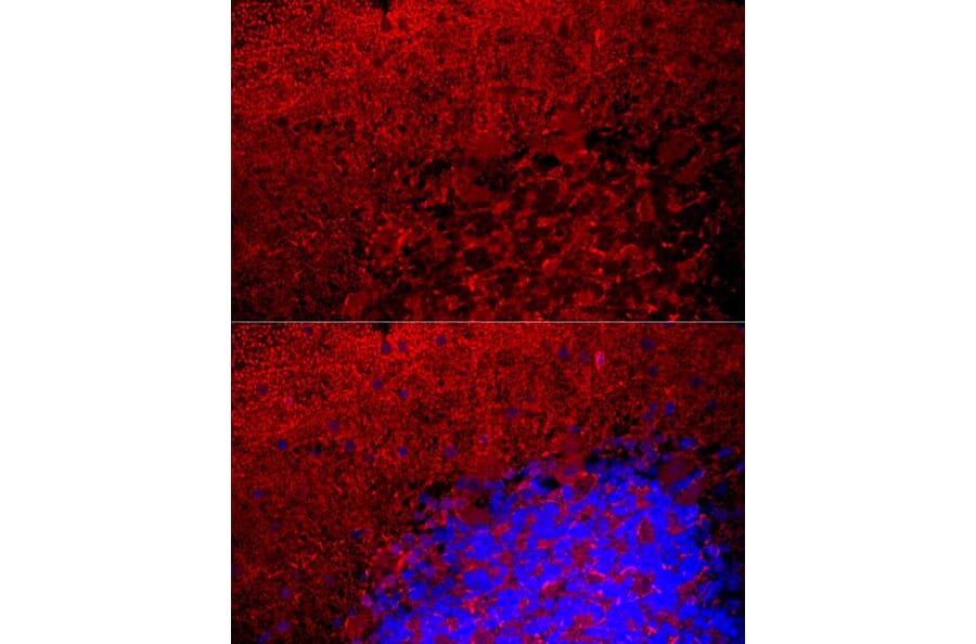 Immunofluorescence - Anti-Myelin Basic Protein Antibody (A13581) - Antibodies.com