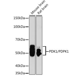 Western Blot - Anti-PDPK1 Antibody (A13582) - Antibodies.com