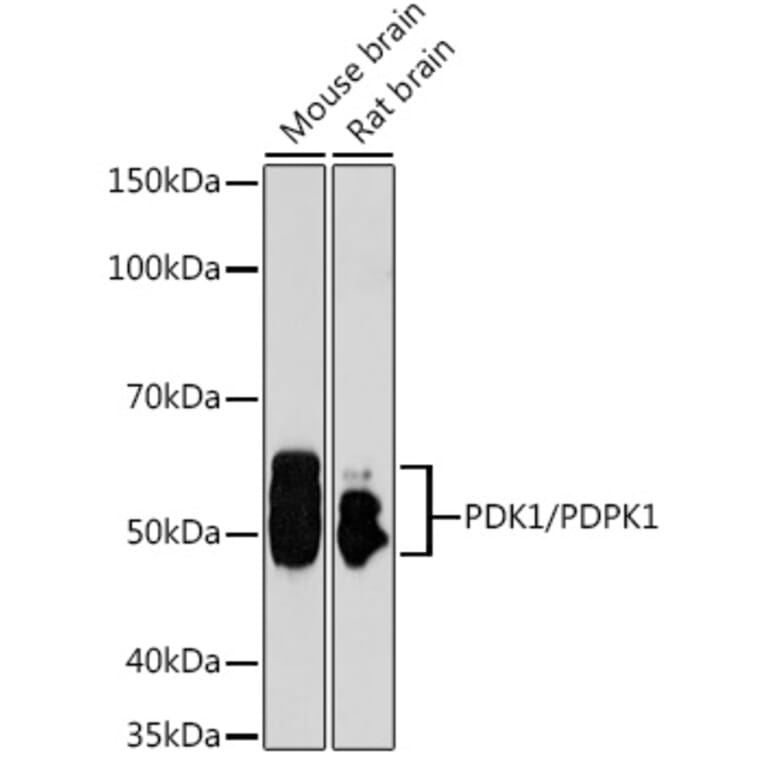 Western Blot - Anti-PDPK1 Antibody (A13582) - Antibodies.com