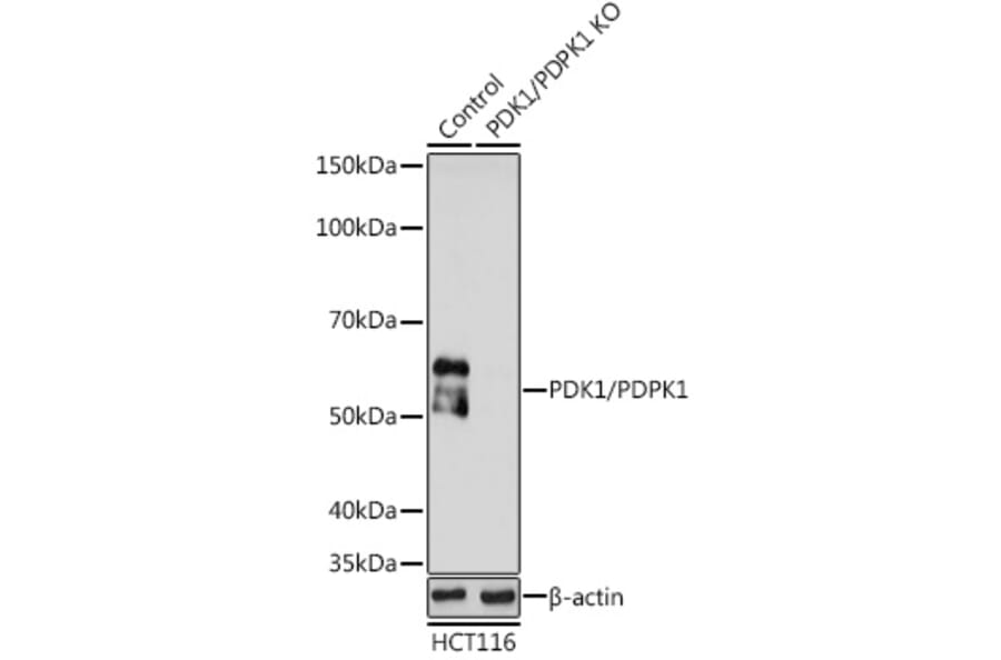 Western Blot - Anti-PDPK1 Antibody (A13582) - Antibodies.com