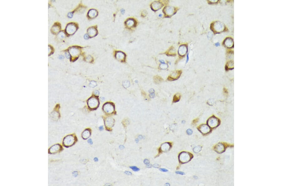 Immunohistochemistry - Anti-PDPK1 Antibody (A13582) - Antibodies.com