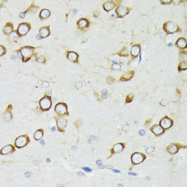 Immunohistochemistry - Anti-PDPK1 Antibody (A13582) - Antibodies.com