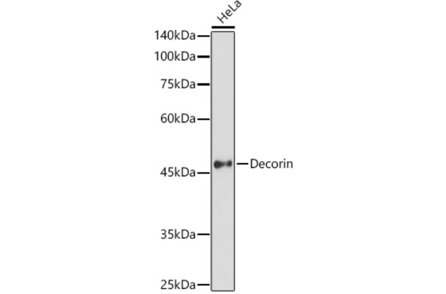 Western Blot - Anti-Decorin Antibody (A13583) - Antibodies.com