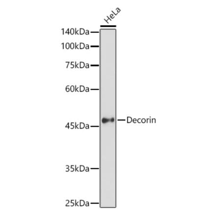 Western Blot - Anti-Decorin Antibody (A13583) - Antibodies.com