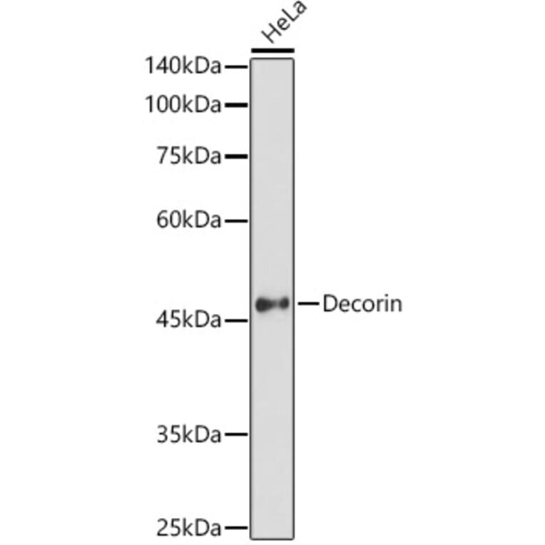 Western Blot - Anti-Decorin Antibody (A13583) - Antibodies.com