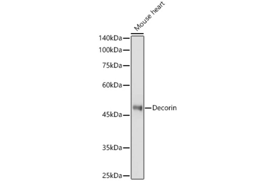 Western Blot - Anti-Decorin Antibody (A13583) - Antibodies.com