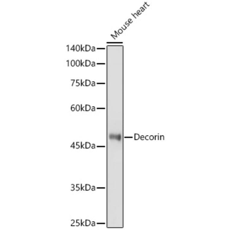 Western Blot - Anti-Decorin Antibody (A13583) - Antibodies.com