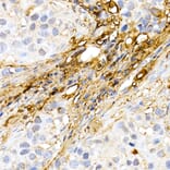 Immunohistochemistry - Anti-Decorin Antibody (A13583) - Antibodies.com