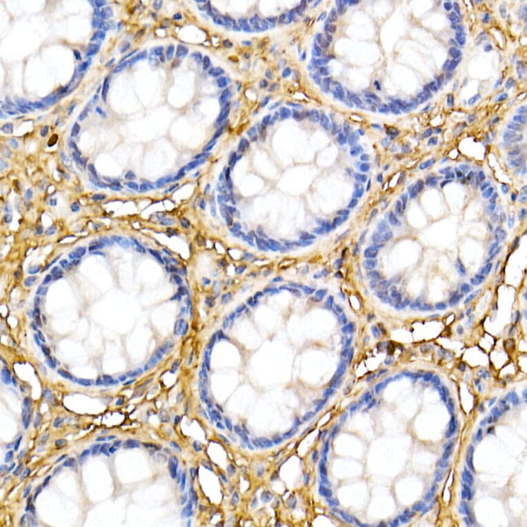 Immunohistochemistry - Anti-Decorin Antibody (A13583) - Antibodies.com