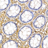 Immunohistochemistry - Anti-Decorin Antibody (A13583) - Antibodies.com