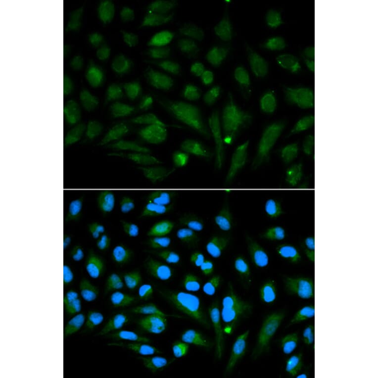 Immunofluorescence - Anti-Decorin Antibody (A13583) - Antibodies.com