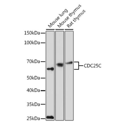 Western Blot - Anti-Cdc25C Antibody (A13584) - Antibodies.com