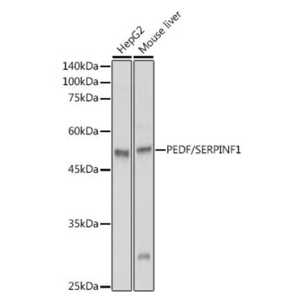 Western Blot - Anti-PEDF Antibody (A13585) - Antibodies.com