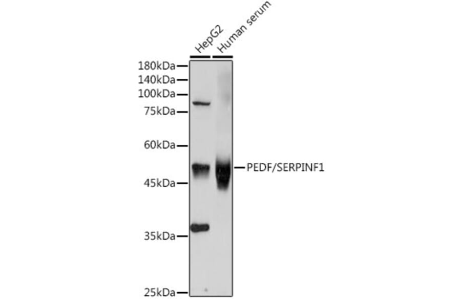 Western Blot - Anti-PEDF Antibody (A13585) - Antibodies.com