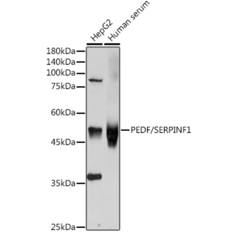 Western Blot - Anti-PEDF Antibody (A13585) - Antibodies.com