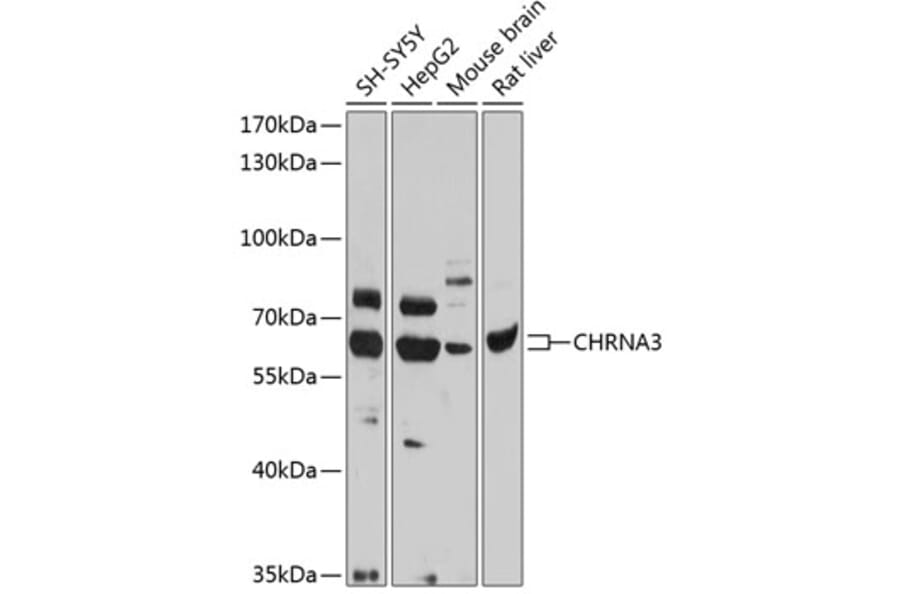 Western Blot - Anti-Nicotinic Acetylcholine Receptor alpha 3/CHRNA3 Antibody (A13586) - Antibodies.com