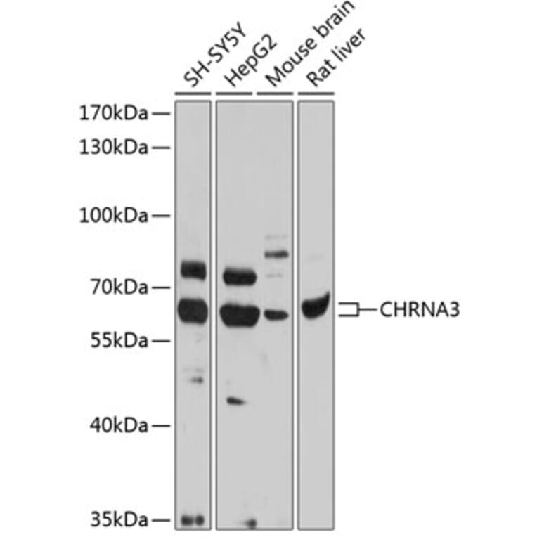 Western Blot - Anti-Nicotinic Acetylcholine Receptor alpha 3/CHRNA3 Antibody (A13586) - Antibodies.com