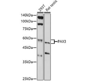 Western Blot - Anti-PAX3 Antibody (A13587) - Antibodies.com