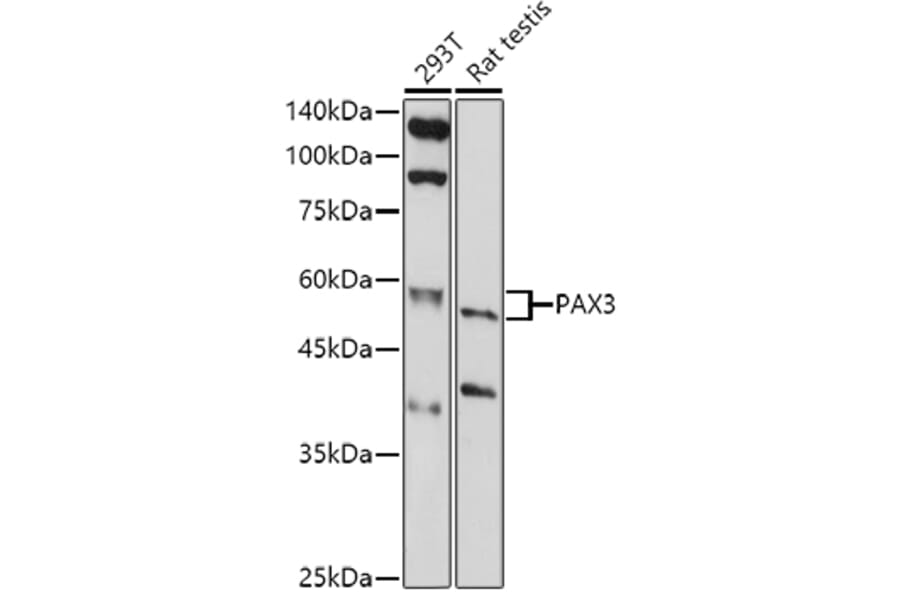 Western Blot - Anti-PAX3 Antibody (A13587) - Antibodies.com