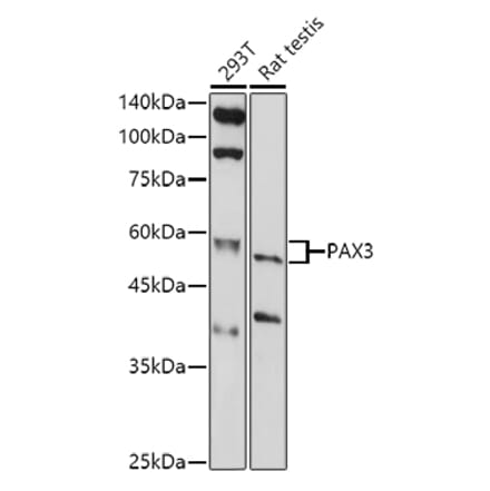Western Blot - Anti-PAX3 Antibody (A13587) - Antibodies.com