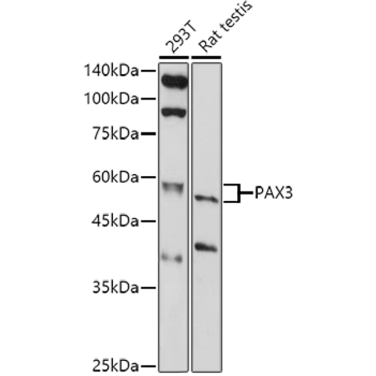Western Blot - Anti-PAX3 Antibody (A13587) - Antibodies.com