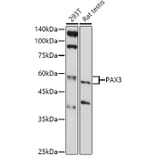 Western Blot - Anti-PAX3 Antibody (A13587) - Antibodies.com
