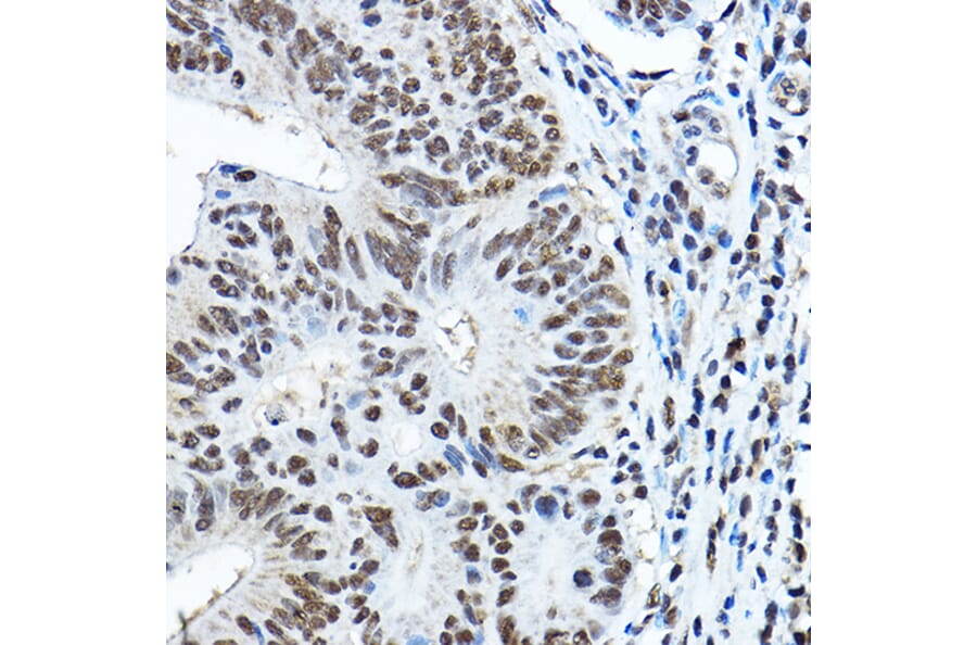 Immunohistochemistry - Anti-PAX3 Antibody (A13587) - Antibodies.com