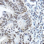 Immunohistochemistry - Anti-PAX3 Antibody (A13587) - Antibodies.com