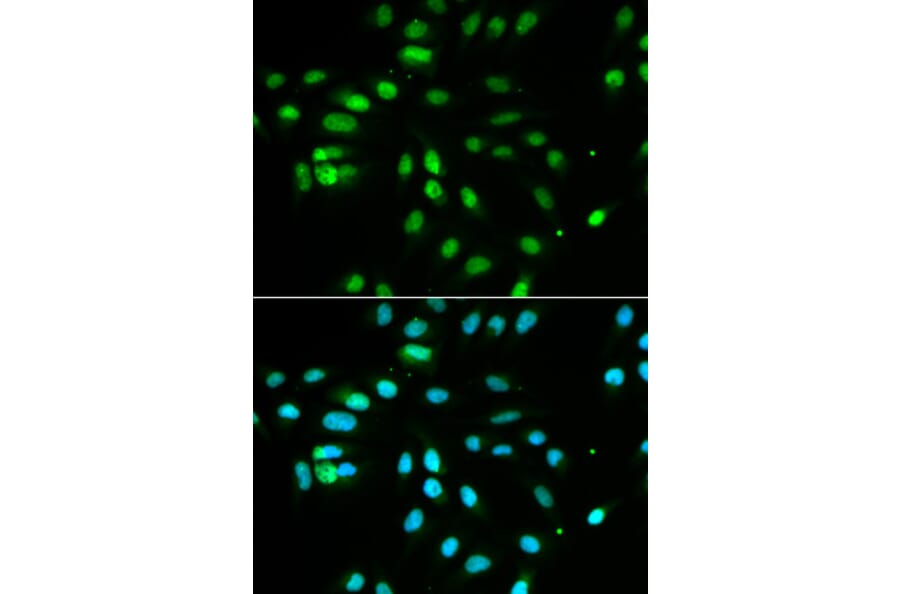 Immunofluorescence - Anti-PAX3 Antibody (A13587) - Antibodies.com