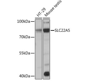 Western Blot - Anti-Solute carrier family 22 member 5 Antibody (A13588) - Antibodies.com