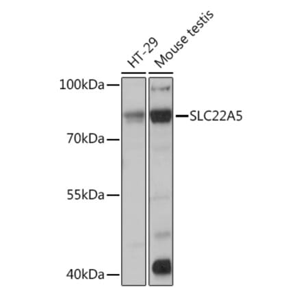 Western Blot - Anti-Solute carrier family 22 member 5 Antibody (A13588) - Antibodies.com