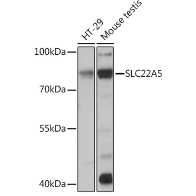 Western Blot - Anti-Solute carrier family 22 member 5 Antibody (A13588) - Antibodies.com