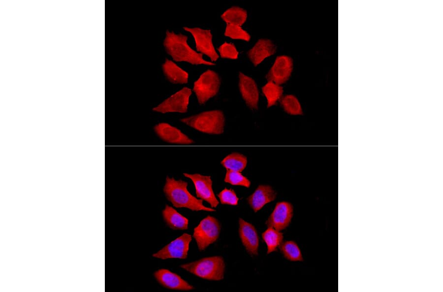 Immunofluorescence - Anti-Solute carrier family 22 member 5 Antibody (A13588) - Antibodies.com