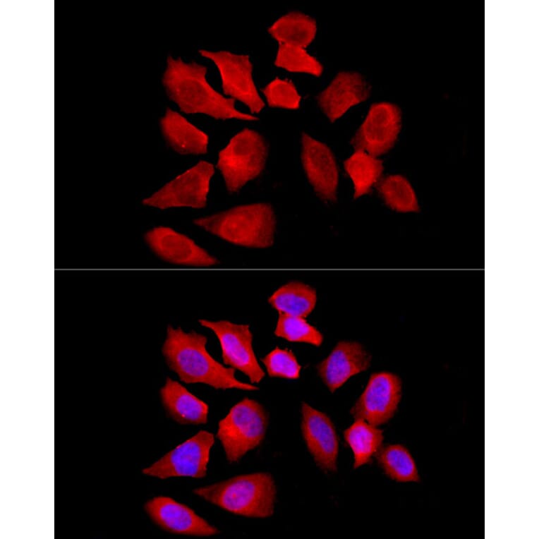 Immunofluorescence - Anti-Solute carrier family 22 member 5 Antibody (A13588) - Antibodies.com