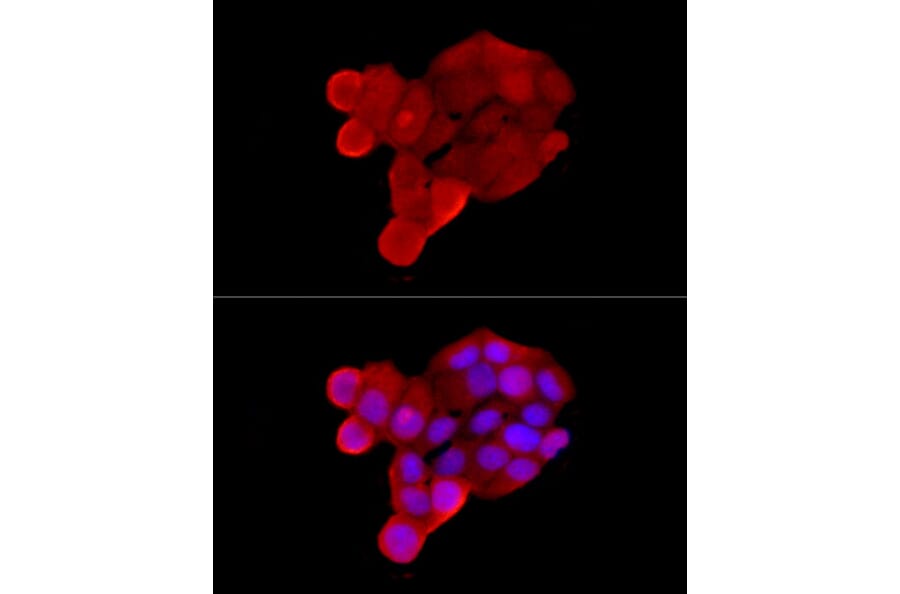 Immunofluorescence - Anti-Solute carrier family 22 member 5 Antibody (A13588) - Antibodies.com