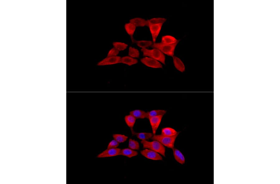 Immunofluorescence - Anti-Solute carrier family 22 member 5 Antibody (A13588) - Antibodies.com