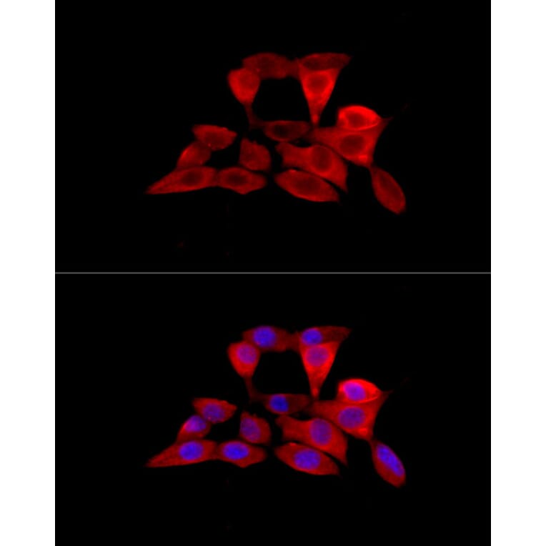 Immunofluorescence - Anti-Solute carrier family 22 member 5 Antibody (A13588) - Antibodies.com