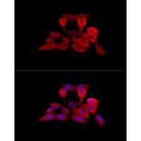 Immunofluorescence - Anti-Solute carrier family 22 member 5 Antibody (A13588) - Antibodies.com