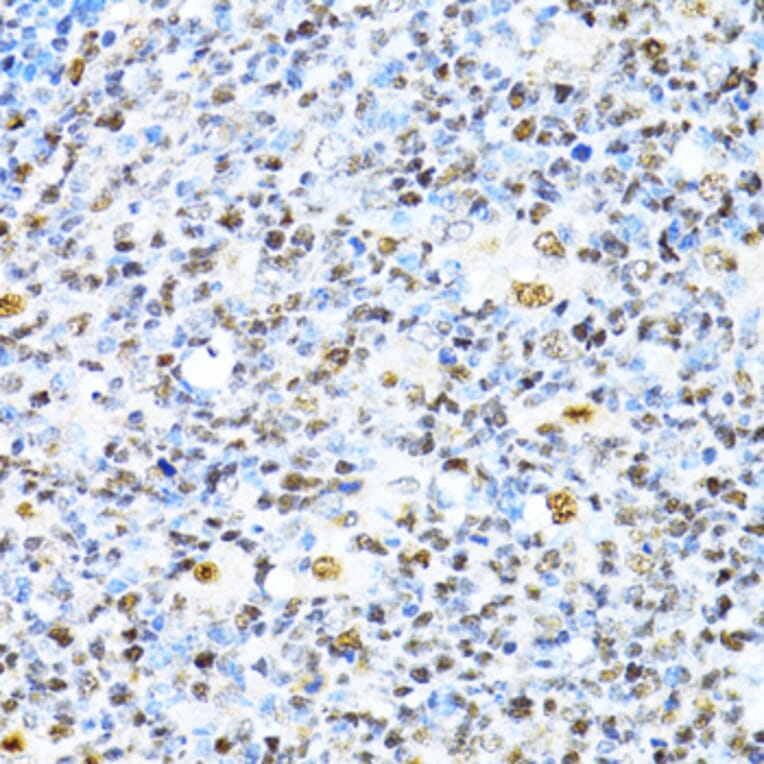 Immunohistochemistry - Anti-XRCC4 Antibody (A13589) - Antibodies.com