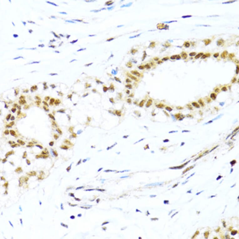 Immunohistochemistry - Anti-XRCC4 Antibody (A13589) - Antibodies.com