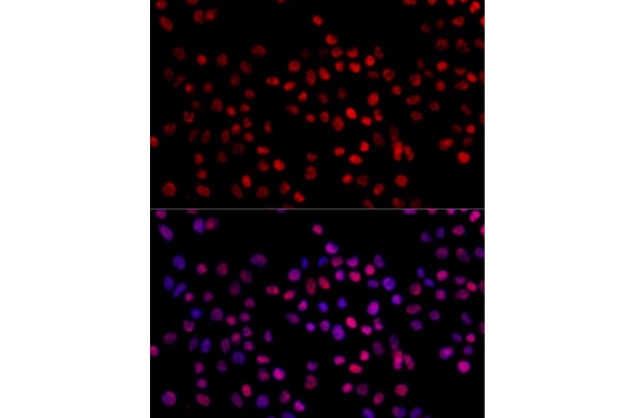 Immunofluorescence - Anti-XRCC4 Antibody (A13589) - Antibodies.com